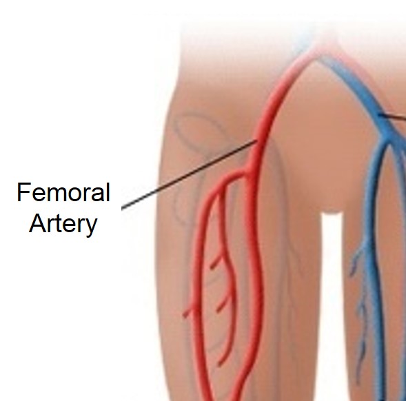 where is the femoral artery